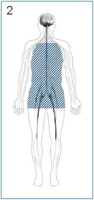 Autonomic Neuropathy